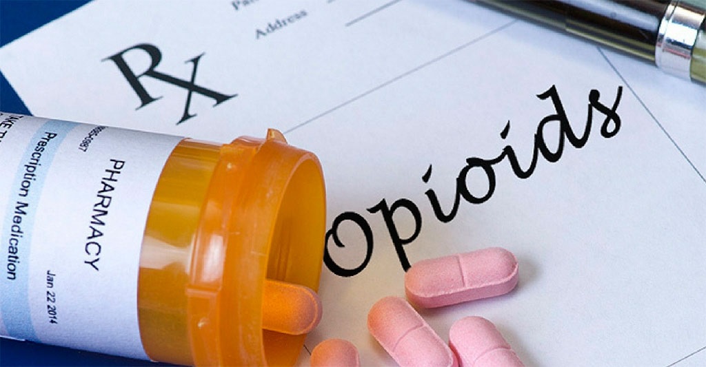 Alertan Sobre Uso De Opioides En Personas Con Enfermedades Cardíacas Noticias Médicas Intramed