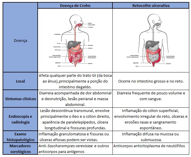 Doença Inflamatória Intestinal Artículos Intramed 1982