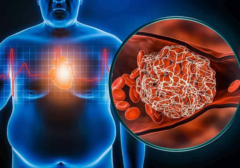 Relação cintura-quadril e mortalidade na insuficiência cardíaca - Medical  Journal >