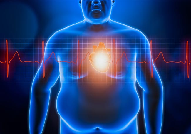 Grasa corporal regional y riesgo cardiovascular - Artículos - IntraMed
